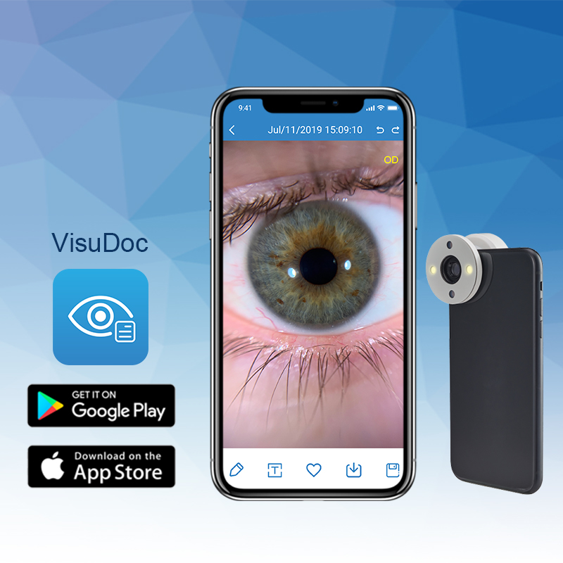 [DK]Smartphone Eye Imaging Adaptor, app
